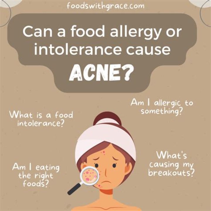 Can food intolerances cause acne?