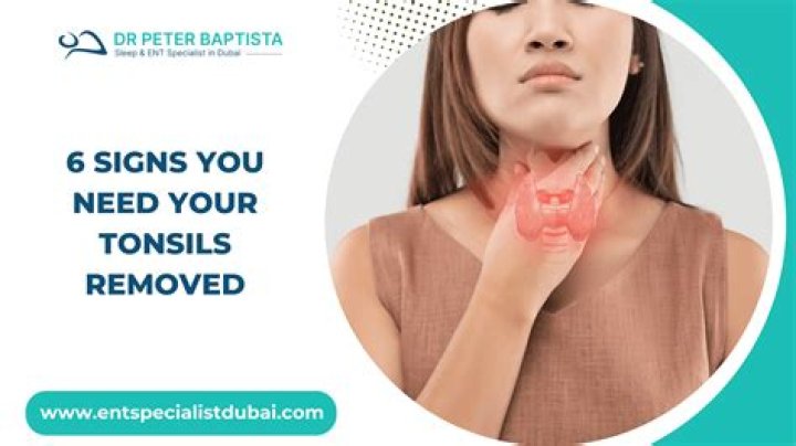 Can tonsils give you bad breath?