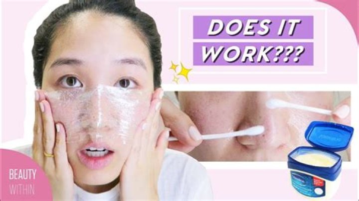 Can Vaseline remove blackheads?