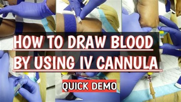 Can you draw below an IV