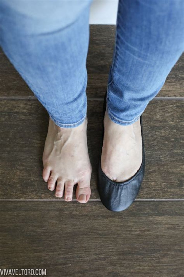 Can you wear Tieks with wide feet?