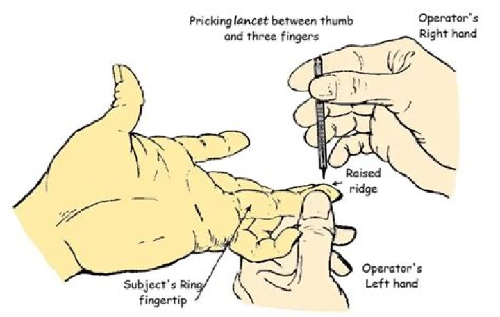 Does pricking your finger hurt?