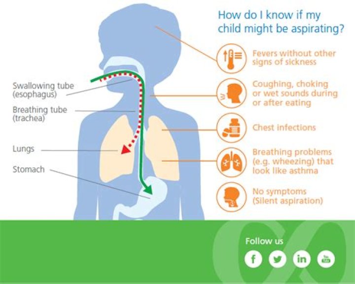 How do you treat infant aspiration?