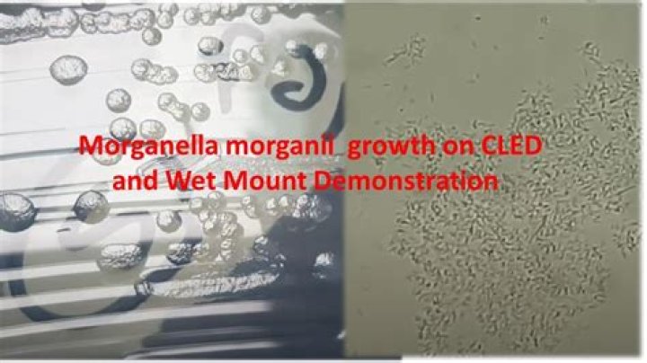 How do you treat morganella Morganii?
