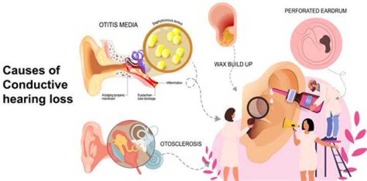 How is conductive hearing loss different from sensory hearing loss?