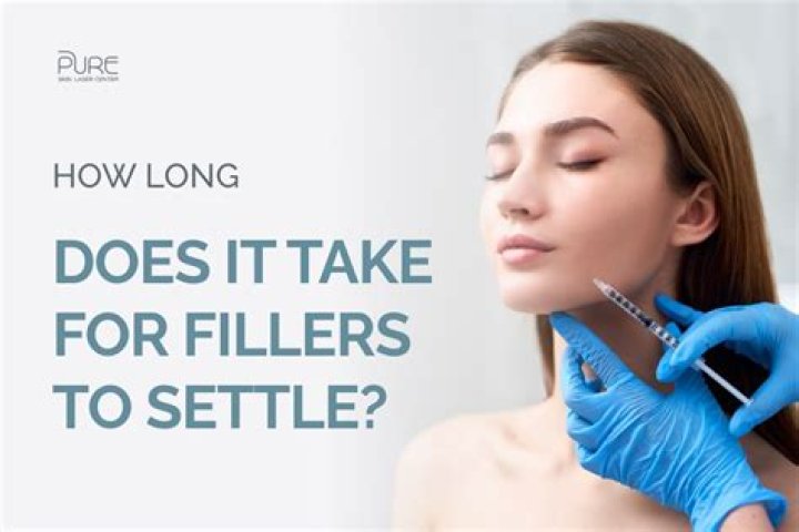 How long does it take for a claim to go through?