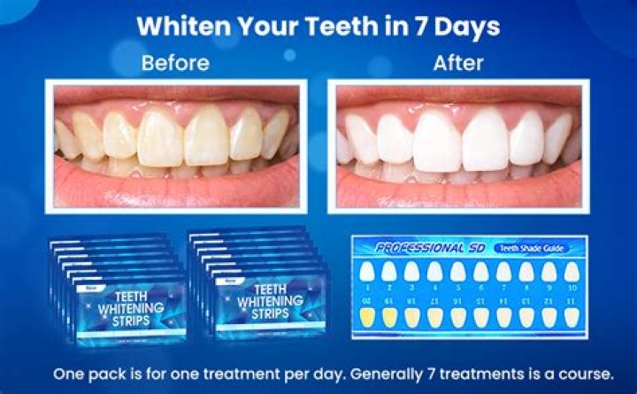 How much to get your teeth whiten?