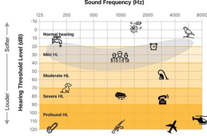 Is a standard threshold shift recordable?