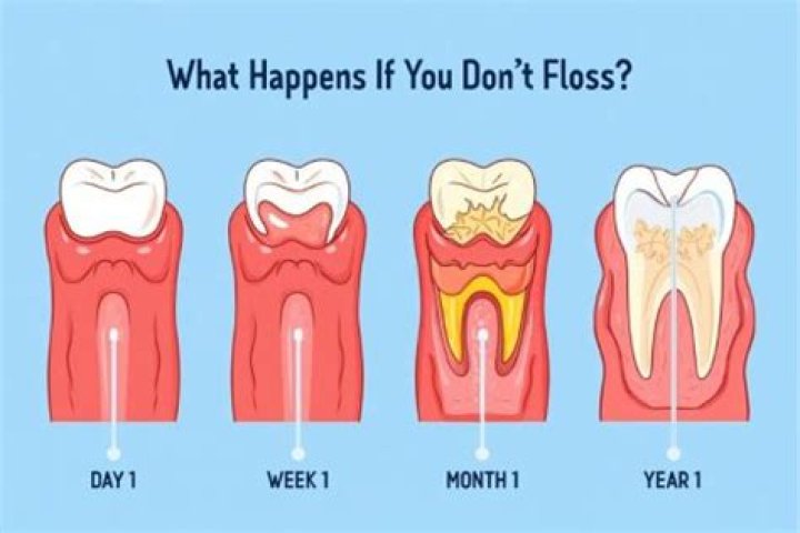 Is it OK to floss once a week?