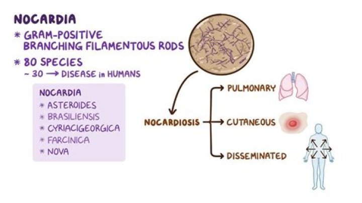 Is nocardia a fungus? | ContextResponse.com