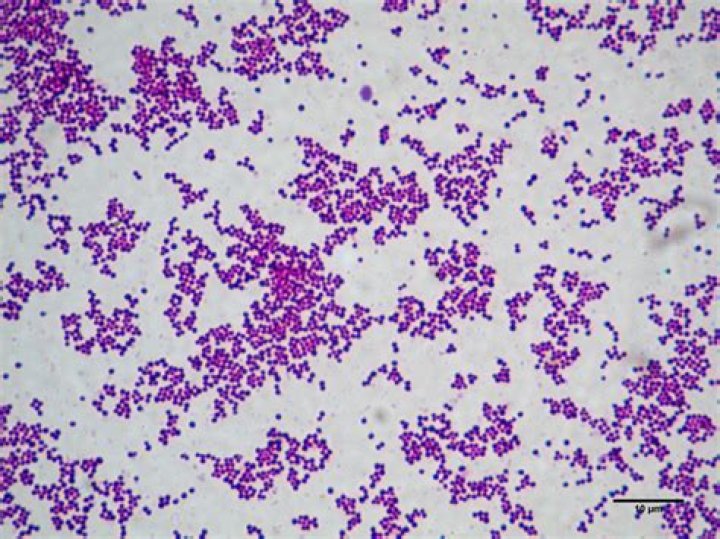 Is Staphylococcus aureus spore forming?