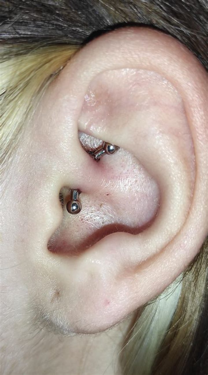 Should I turn my Daith piercing?