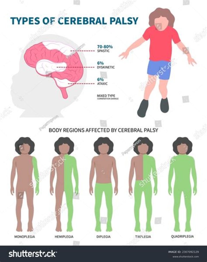 What are different types of cerebral palsy?
