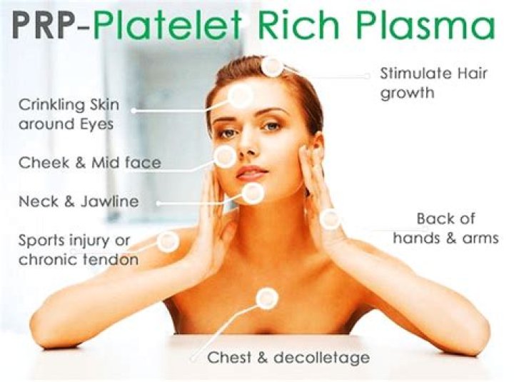 What are the side effects of PRP injections?