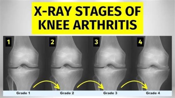 What can an xray tell you?