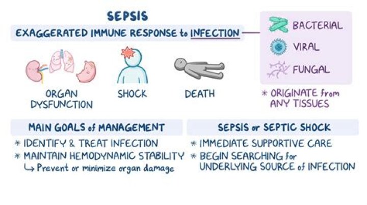 What does a sepsis nurse do?