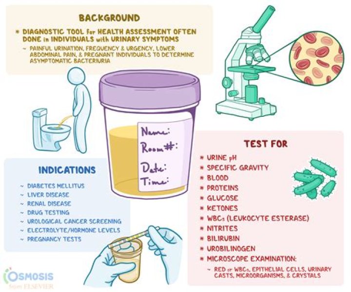 What does a urine culture test for?