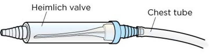 What is a Heimlich valve chest tube?