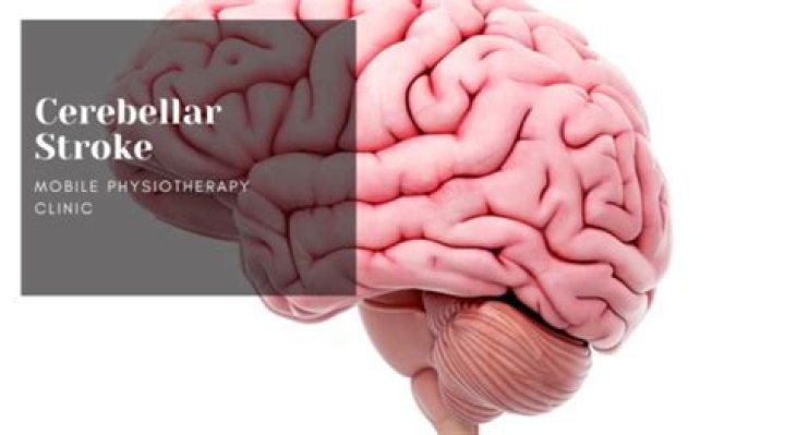 What is cerebellar stroke?