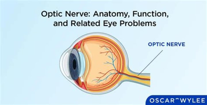 Which nerve is connected to the eye to the ear?