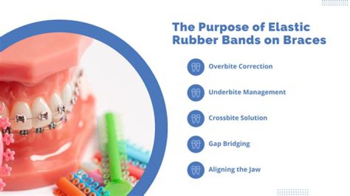 Why do I chew on rubber bands?